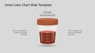 Template for Urine Color Chart Presentation