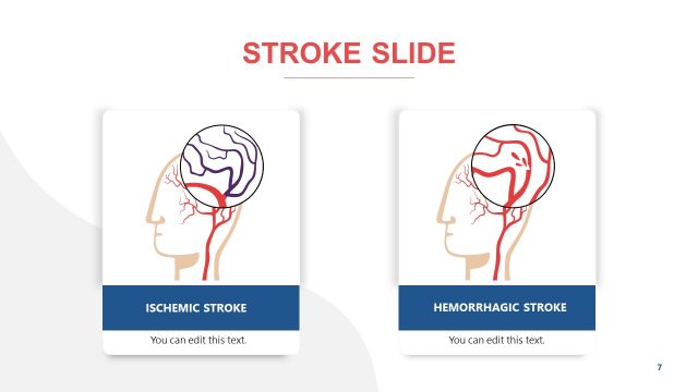 Template for Types of Stroke
